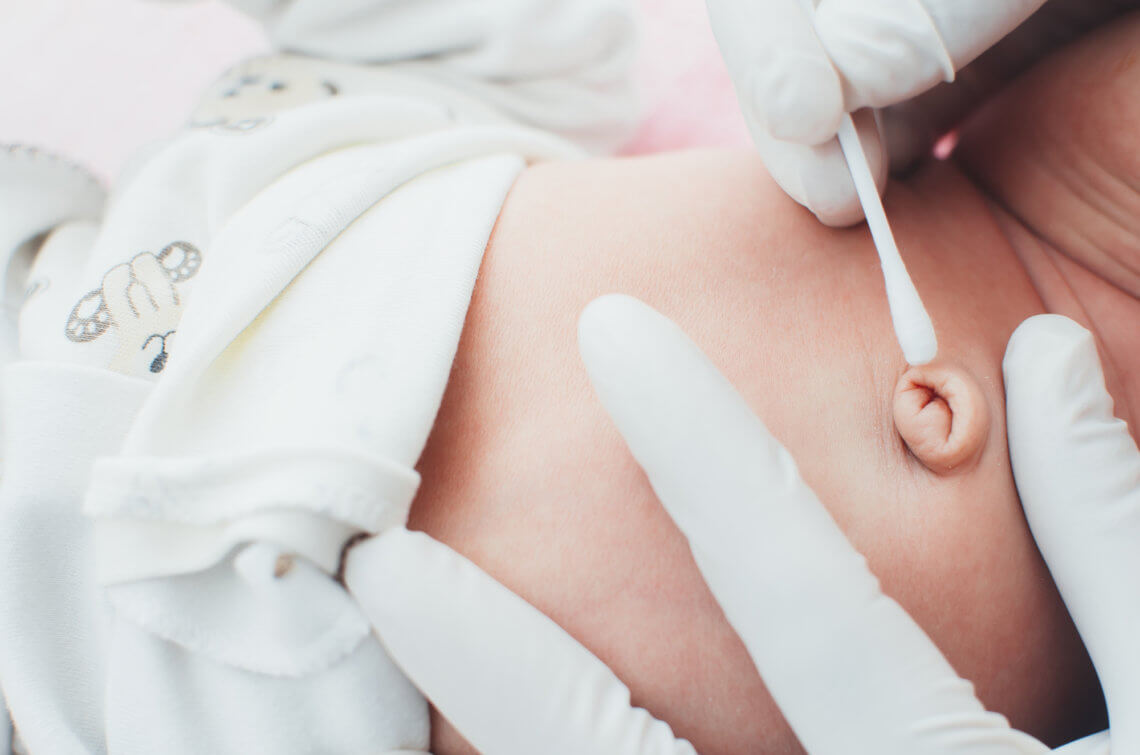 Jak dbać o pępek noworodka, czyli o prawidłowej pielęgnacji